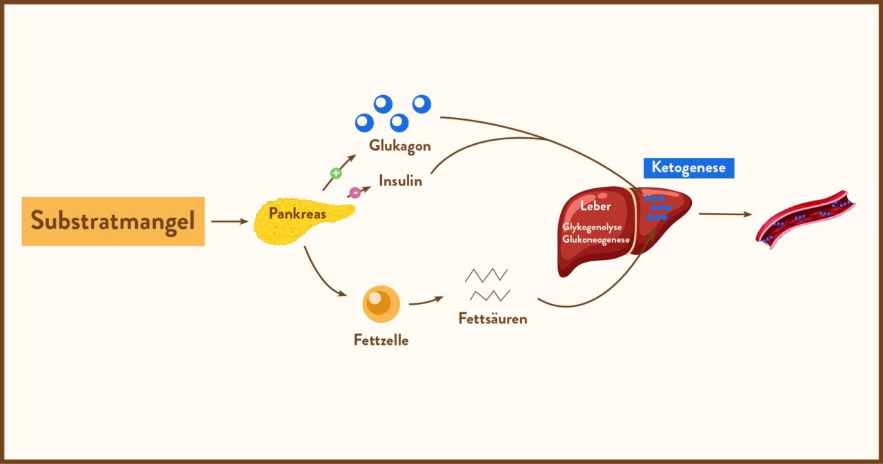Infografik des Stoffwechselprozesses bei Substratmangel, der die Rolle von Pankreas, Fettzellen und Leber bei der Ketogenese zeigt.